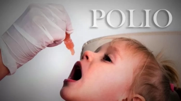 Tiga Anak di Jateng dan Jatim Alami Lumpuh Layu Akut Akibat Virus Polio