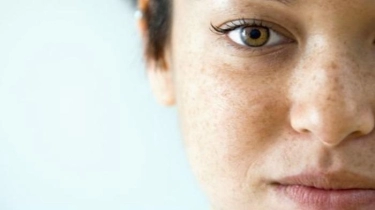 Tips Hilangkan Flek Hitam Serta Peringatan Bahaya Skincare Abal-abal