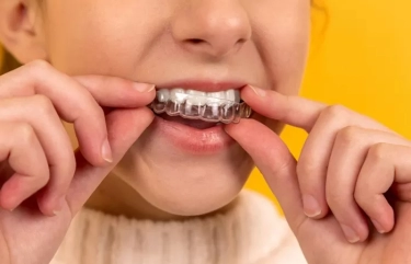 6 Manfaat Merapikan Gigi dengan Clear Aligner!