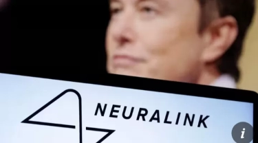 Pertama Kali! Elon Musk Katakan Neuralink Telah Menanamkan Chip Pada Otak Manusia