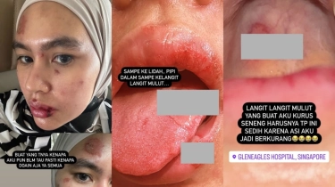 5 Koleksi Tas Mewah Milik Kartika Putri, Tak Heran Rela Bayar Mahal Berobat ke Singapura