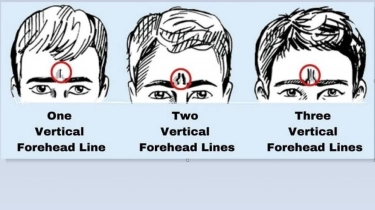 Tes Kepribadian: Cari Tahu Sifat Seseorang Lewat Garis Dahinya