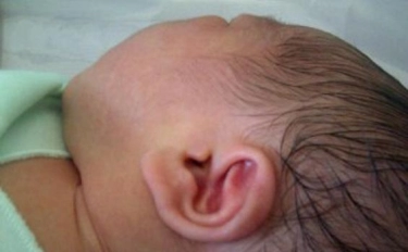 Kenali Tanda-Tanda Gangguan Pendengaran Pada Bayi yang Perlu Diwaspadai 