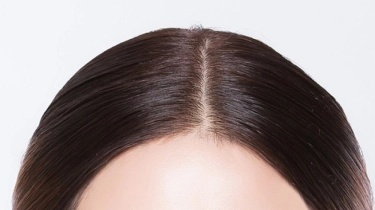 Mengenal Manfaat Niacinamide, Senjata Rahasia untuk Scalp Barrier yang Sehat