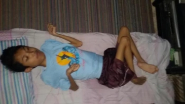 Kasus Lumpuh Layu Muncul Lagi, 8,7 Juta Anak Indonesia Dijangkau Vaksin Polio