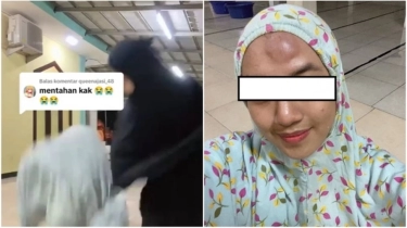 Viral Dahi Cewek Ini Benjol Usai Bikin Video TikTok di Masjid, Endingnya Minta Maaf