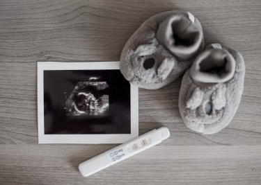 Istri Denny Sumargo Berhasil Hamil dengan Proses IVF, Berikut Penjelasan Prosedur serta Risikonya