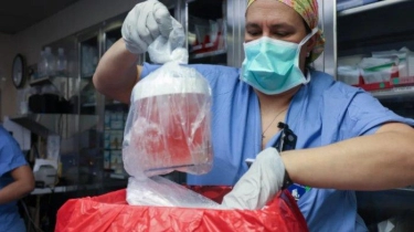 Ahli Bedah AS Transplantasikan Ginjal Babi ke Manusia, Operasi Berlangsung 4 Jam