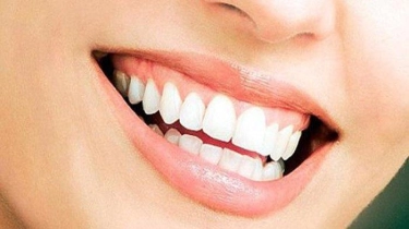 Dokter Jelaskan Alasan Tidak Boleh Cabut Gigi saat Sakit Gigi