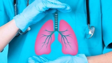 Kedua Tertinggi di Dunia Kemenkes, Ungkap Ada Satu Juta Lebih Orang hidup dengan TBC di Indonesia