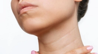 Penyebab Leher Lebih Cepat Menua daripada Wajah dan Cara Mengatasinya