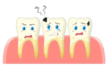 Ampuh! Inilah 3 Bahan Rumahan Mampu Menghilangkan Karang Gigi