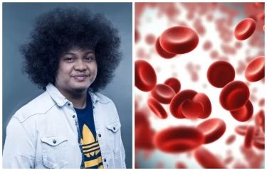 Mengenal Anemia Aplastik, Penyakit Langka yang Diderita Babe Cabita sebelum Meninggal Dunia