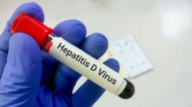 Ada 3.500 Orang Meninggal Setiap Harinya, WHO Ingatkan Soal Bahaya Virus Hepatitis