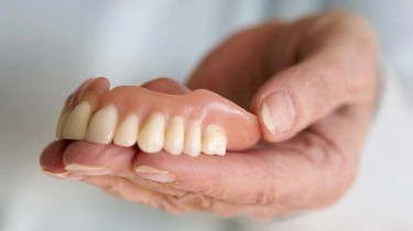 Perlu Saran Dokter untuk Menentukan Pilihan antara Pakai Gigi Palsu atau Implan Gigi