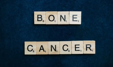 Jarang Diketahui, Berikut 5 Jenis Kanker Tulang yang Bisa Menyerang Tubuh Kapan Saja