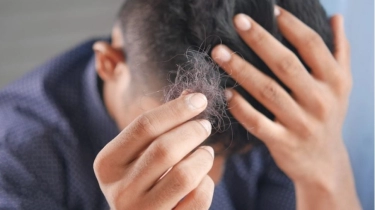 Benarkah Rambut Panjang Lebih Sering Rontok? Dokter Bilang Begini
