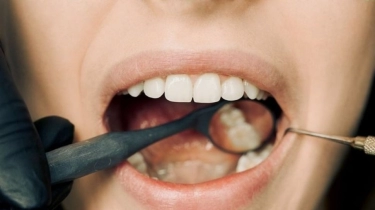 Jangan Sepelekan! Ini Dampak Buruk Jarang Periksa Gigi Setiap 6 Bulan Sekali