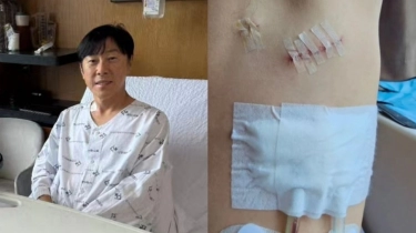 Shin Tae-yong Unggah Foto Kondisi Usai Operasi Radang Selaput Paru Pleuritis, Ada Bekas Luka di Rusuk Kiri