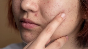 Takut Skincare Berbahaya Saat Hamil? Dokter Kandungan Beeleonie Beri Solusi Alami dan Aman