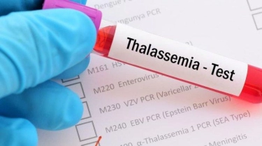 Thalasemia Tidak Bisa Dicegah, Penting Skrining Sebelum Menikah agar Tidak Menurun ke Anak