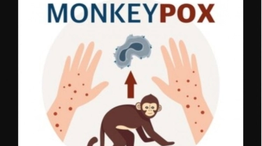 Infeksi Monkeypox Di RI Tembus 88 Kasus, Pemerintah Akan Isolasi Orang Dari Luar Negeri Bila Alami Demam