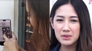 Sahabat Perlihatkan Foto Tubuh Tamara Tyasmara yang Lebam, Diduga Efek Kekerasan Dari Yudha Arfandi