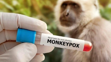 Droplet Bisa Menjadi Pemicu Penularan Monkeypox, Epidemiolog Bagikan Kiat Pencegahannya