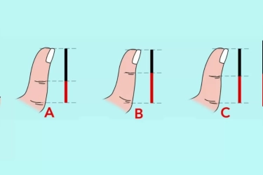 Tes Kepribadian: Ukuran Jempol Kamu Dapat Tunjukkan Karakter Tersembunyi Dirimu, Ini Penjelasannya!