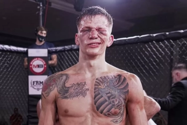 Andrew Richardson Petarung UFC yang Harus Pensiun Efek Jangka Panjang Operasi Pengangkatan Tumor Otak