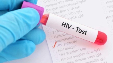 Dokter Sarankan Lakukan Tes HIV Bagi Pasangan yang Ingin Menikah