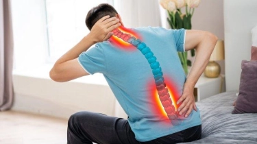 Dokter Spesialis Ortopedi Jelaskan Lumbar Disc Replacement, Penanganan pada Masalah Tulang Belakang