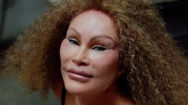 Jocelyn Wildenstein, Sosialita yang Dijuluki Pecinta Operasi Plastik, Meninggal Dunia saat Tidur