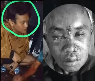 Viral! ODGJ Dikeroyok Warga di Bandung Barat, Dituduh Mencuri Mobil, Keluarga : Nyetir Mobil Aja Gak Bisa