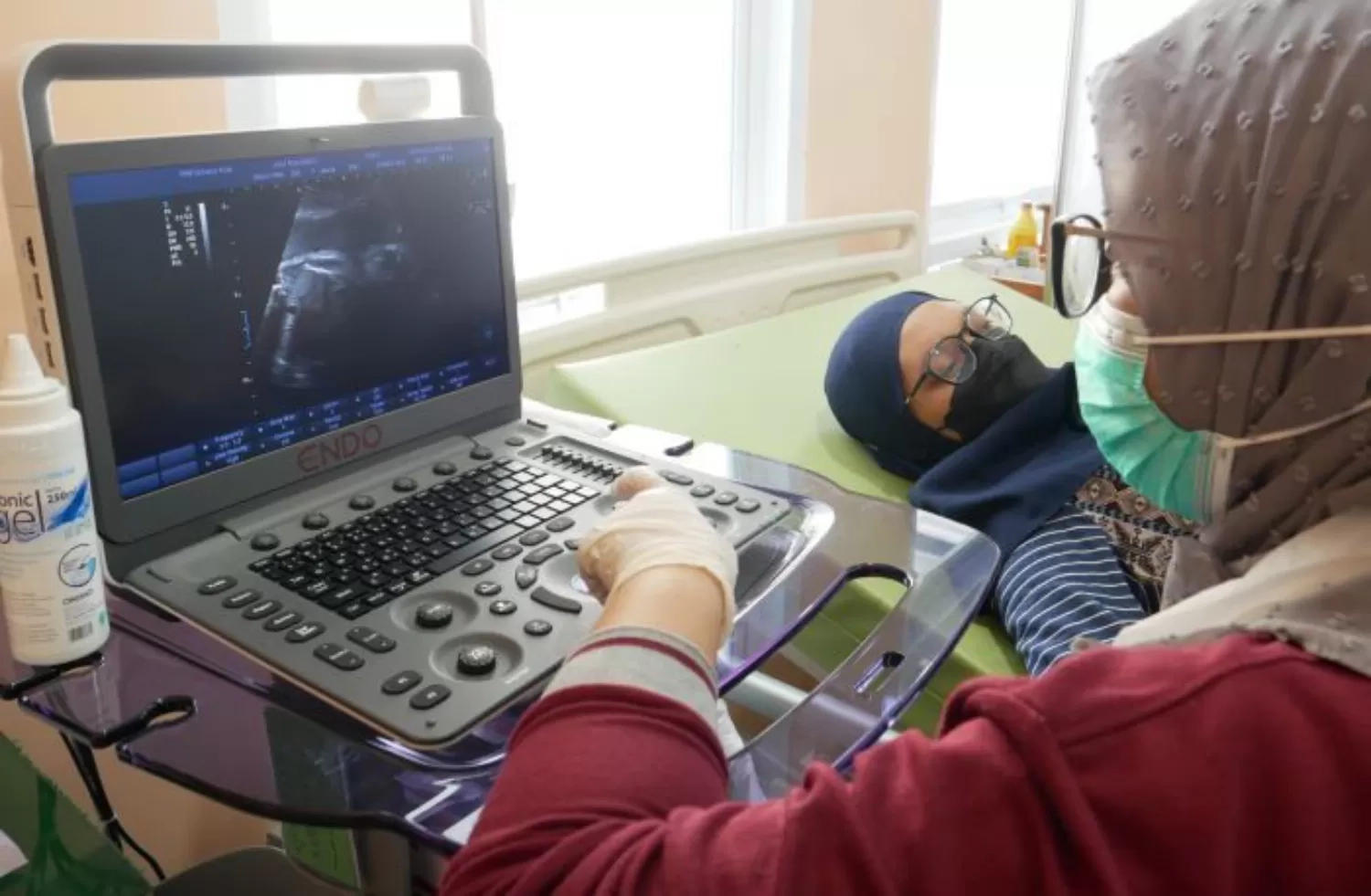 Dokter Kandungan Jelaskan prosedur Pemeriksaan USG Kehamilan yang Benar, Sebut Pemeriksaan USG Jarang Sentuh Bagian Tubuh Selain Perut