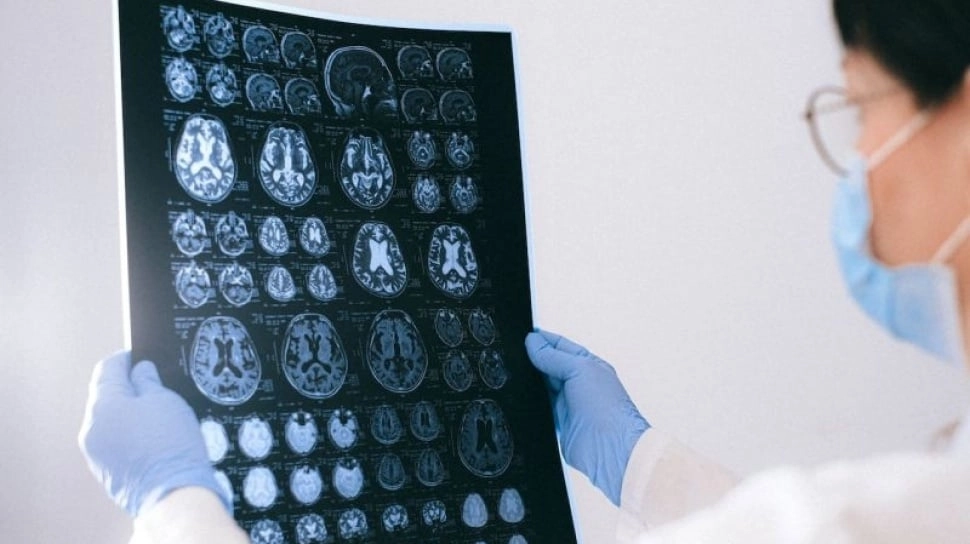 Paus Fransiskus Meninggal Akibat Stroke: Kenali Gejala, Penyebab, dan Pencegahannya