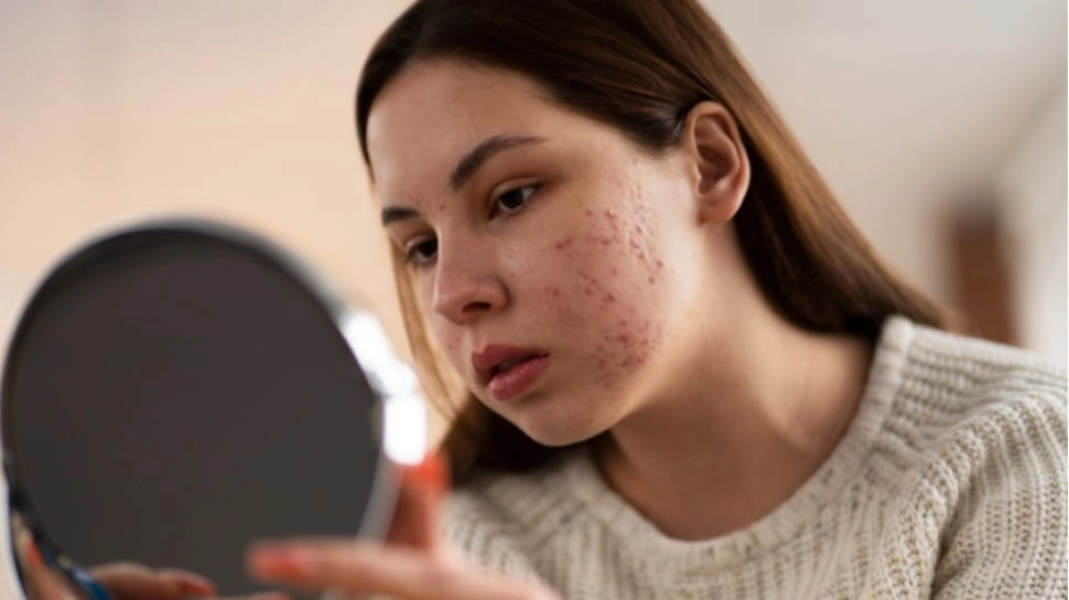 7 Rekomendasi Retinol Lokal yang Ampuh Hilangkan Flek Hitam