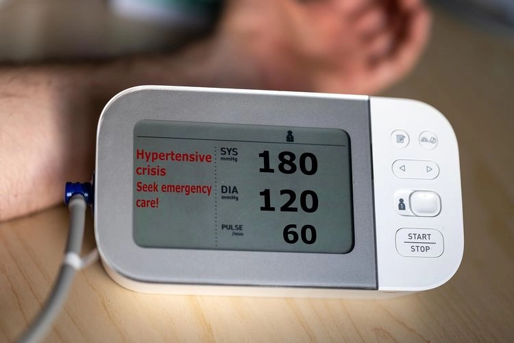 Kenali Gejala Krisis Hipertensi, Ketika Tekanan Darah 180/120 MmHg