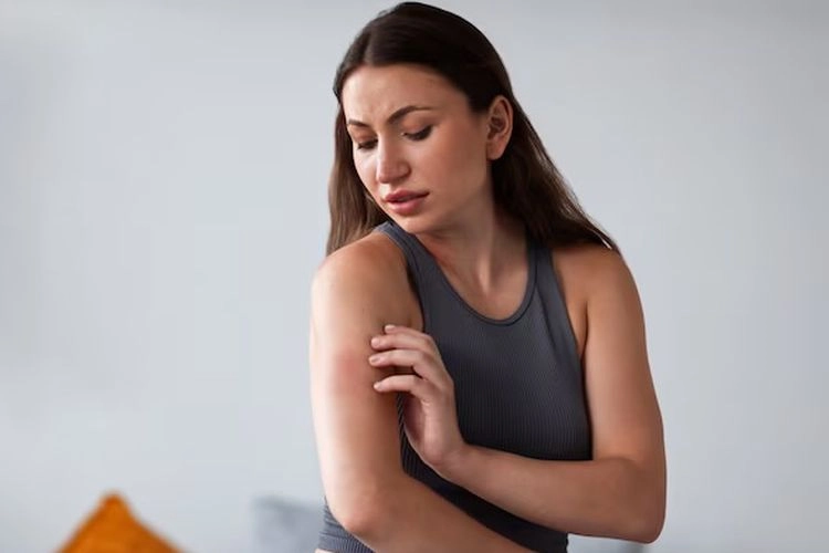 Banyak Diderita Perempuan Muda, Ini Penyebab Lupus