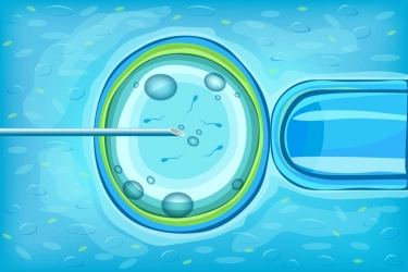 Berapa Lama Sel Telur Bisa Disimpan dalam Prosedur Egg Freezing, seperti Luna Maya?