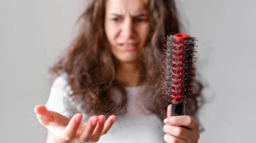 Cegah Kebotakan, 5 Makanan Ini Bisa Tumbuhkan Rambut Secara Alami