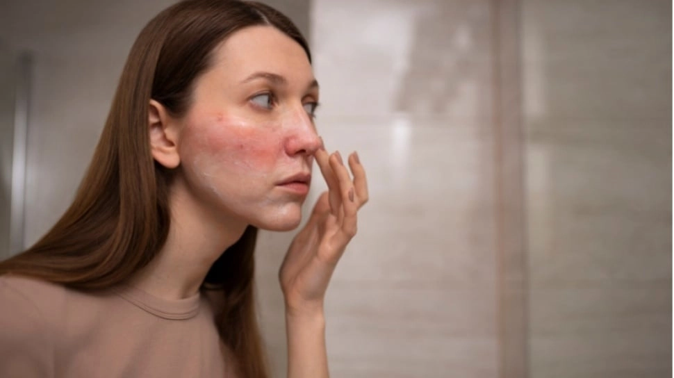 Rangkaian Skincare Viva Ampuh Mengatasi Jerawat, Harga Ekonomis Anti Ribet