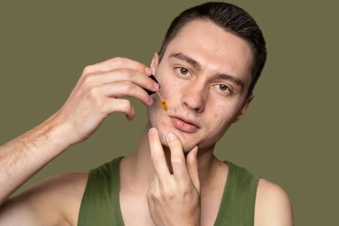 5 Manfaat Tea Tree Oil untuk Wajah Sekaligus Cara Menggunakannya, Mulai dari Atasi Jerawat hingga Redakan Gatal