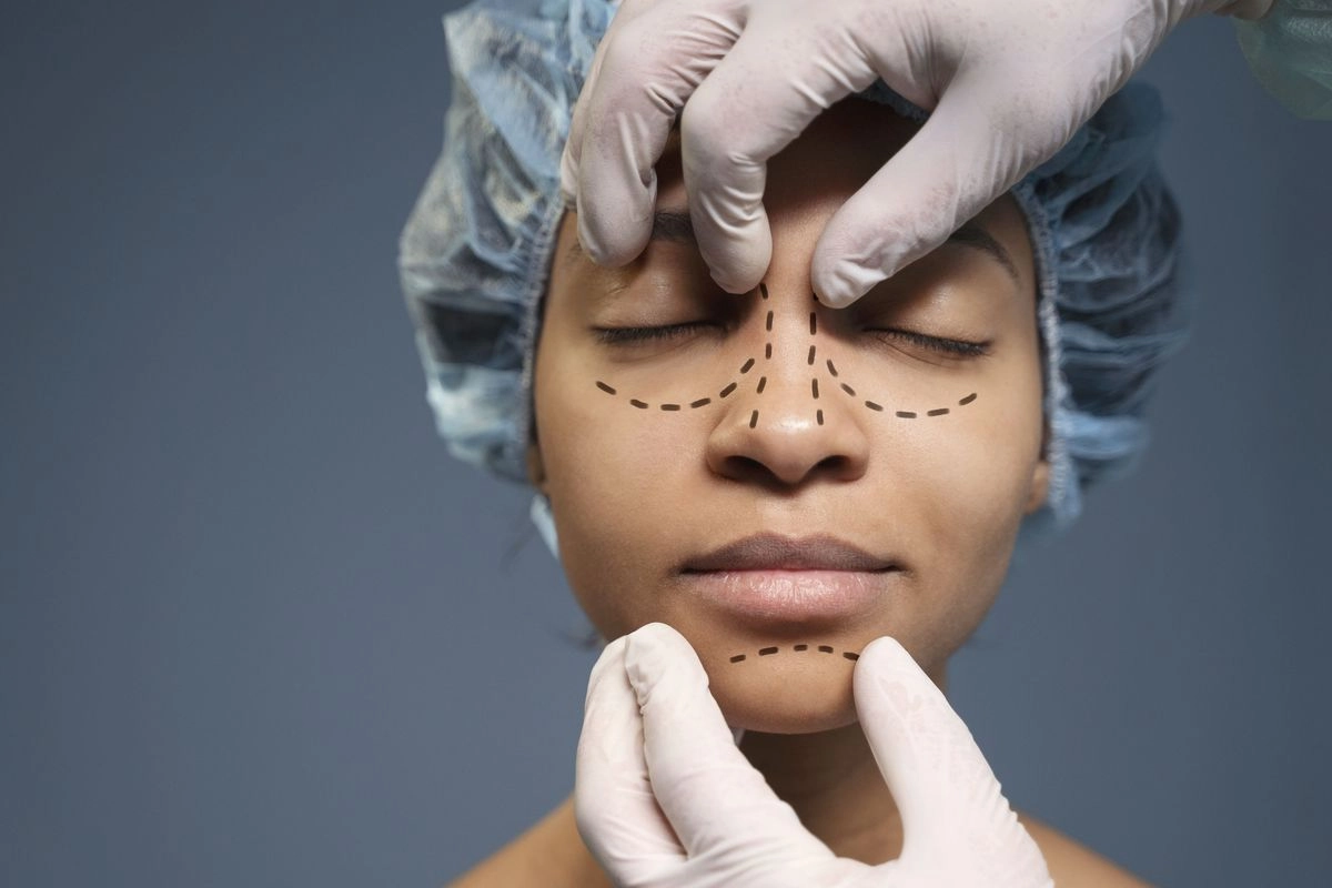 5 Hal yang Harus Diperhatikan Sebelum Operasi Hidung Rhinoplasty
