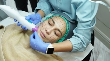 Intip Treatment Luna Maya Sebelum Pernikahan, Kulit Jadi Terlihat Lebih Awet Muda