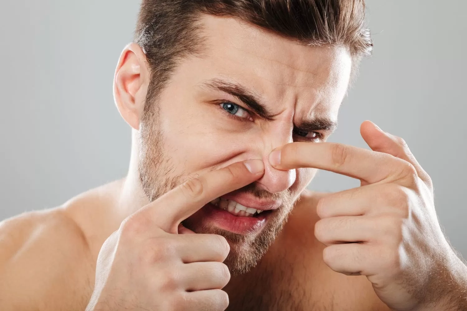 4 Obat Alami untuk Mengatasi Jerawat di Hidung, Apa Saja?