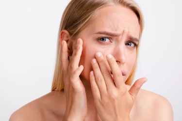 10 Penyebab Milia di Bawah Mata yang Jarang Disadari, Bisa Jadi Faktor Genetik atau Kerusakan Kulit!