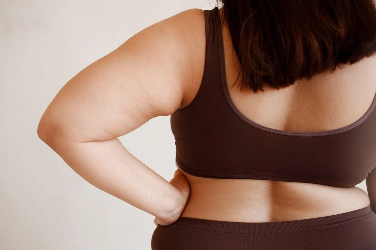 Cara Baru Atasi Lemak Subkutan yang Susah Hilang