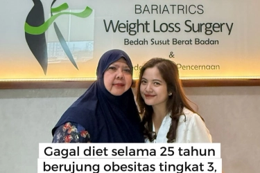 Ibu Tasya Kamila Pilih Operasi Bariatrik, Siapa yang Bisa Menjalaninya?