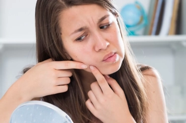 3 Kebiasaan Buruk yang Bikin Jerawatmu Makin Parah Meski Rajin Skincare-an, Stop dari Sekarang